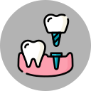 برنامه‌ریزی ایمپلنت و طراحی گاید جراحی | Implant Planning